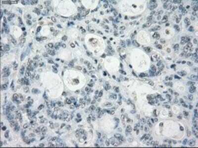 Immunohistochemistry: Aurora C Antibody (OTI2B7) - Azide and BSA Free [NBP2-71303]
