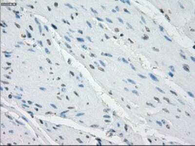 Immunohistochemistry: Aurora C Antibody (OTI2B7) - Azide and BSA Free [NBP2-71303]