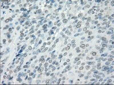 Immunohistochemistry: Aurora C Antibody (OTI2B7) - Azide and BSA Free [NBP2-71303]