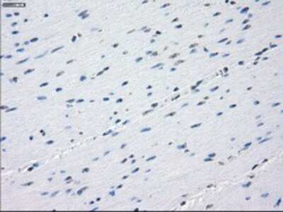 Immunohistochemistry: Aurora C Antibody (OTI2B7) - Azide and BSA Free [NBP2-71303]