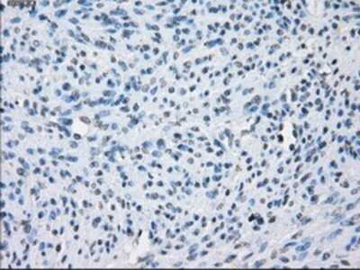 Immunohistochemistry: Aurora C Antibody (OTI2B7) - Azide and BSA Free [NBP2-71303]