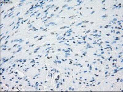 Immunohistochemistry: Aurora C Antibody (OTI2B7) - Azide and BSA Free [NBP2-71303]