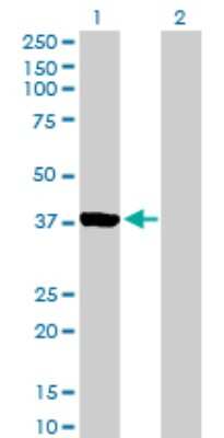 Western Blot: Aurora C Antibody [H00006795-B01P]