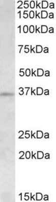 Western Blot: Aurora C Antibody [NBP1-52004]