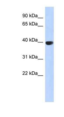 Western Blot: Aurora C Antibody [NBP1-54994]