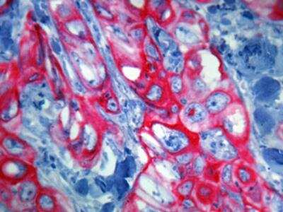 Immunohistochemistry-Paraffin: AutoRED AP Plus Staining Kit (Colorimetric) [NBP3-12172]