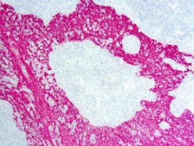 Immunohistochemistry-Paraffin: AutoRED AP Staining Kit (Colorimetric) [NBP3-12173]