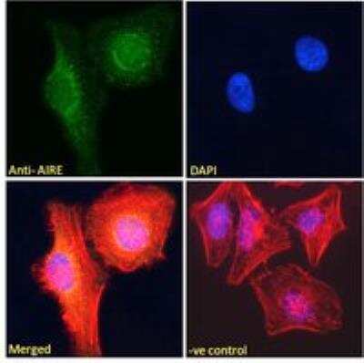 Immunocytochemistry/ Immunofluorescence: Autoimmune Regulator/AIRE Antibody [NB100-1063]