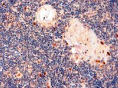 Immunohistochemistry-Paraffin: Autoimmune Regulator/AIRE Antibody [NB100-1063]