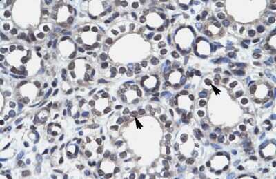 Immunohistochemistry-Paraffin: Autoimmune Regulator/AIRE Antibody [NBP3-10950]