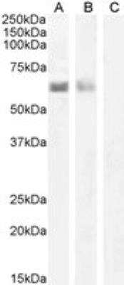 Western Blot: Autoimmune Regulator/AIRE Antibody [NB100-1063]