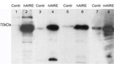 Western Blot: Autoimmune Regulator/AIRE Antibody [NB100-40799]