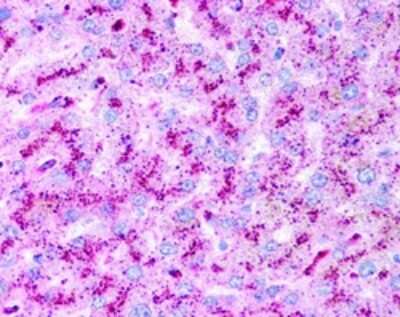 Immunohistochemistry: Autophagy Antibody Pack [NB910-94159]