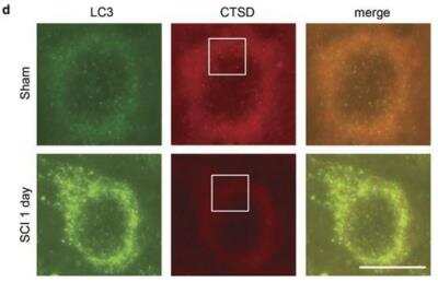 Immunohistochemistry: Autophagy Antibody Pack [NB910-94159]