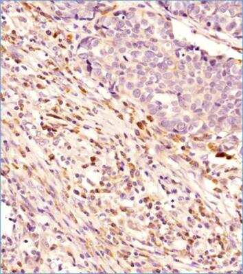 Immunohistochemistry: Autophagy Antibody Pack [NB910-94159]