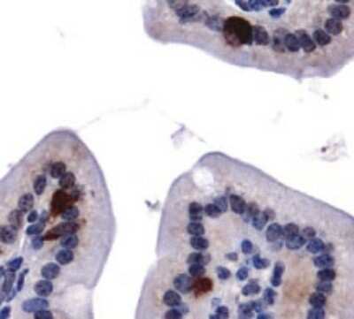 Immunohistochemistry: Autophagy Antibody Pack [NB910-94877]