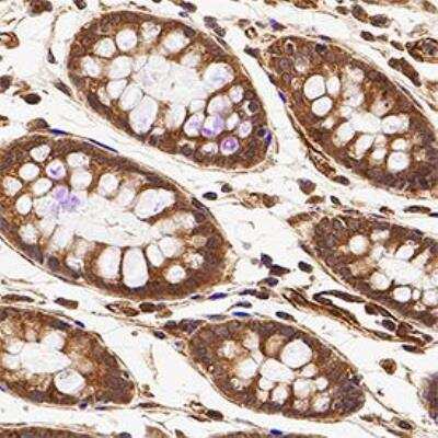 Immunohistochemistry: Autophagy Antibody Pack [NB910-94877]