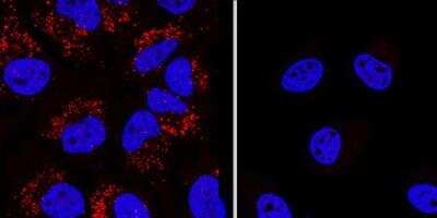 Knockout Validated: Autophagy Antibody Pack [NB910-94159]