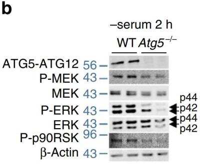 Knockout Validated: Autophagy Antibody Pack [NB910-94159]