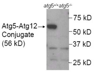 Western Blot: Autophagy Antibody Pack [NB910-94159]