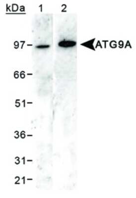 Western Blot: Autophagy Antibody Pack [NB910-94159]