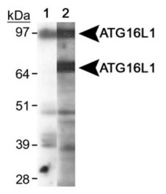 Western Blot: Autophagy Antibody Pack [NB910-94159]