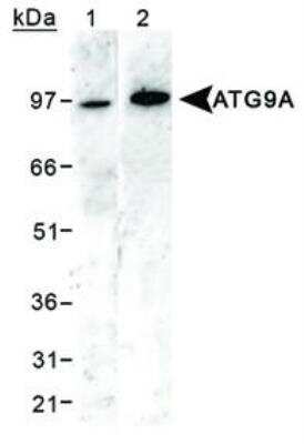 Western Blot: Autophagy Antibody Pack [NB910-94159]