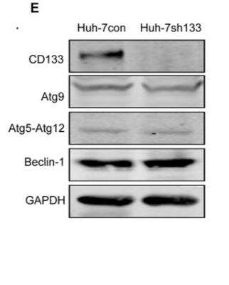 Western Blot: Autophagy Antibody Pack [NB910-94877]