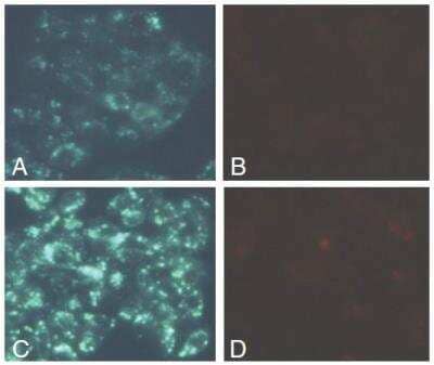 Functional: Autophagy/Cytotoxicity Dual Staining Kit [KA1299]