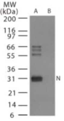 Western Blot: Avian Influenza A H6N1 Nucleoprotein Antibody [NB100-56611]