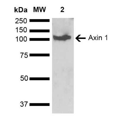 Western Blot: Axin-1 Antibody [NBP3-18242]