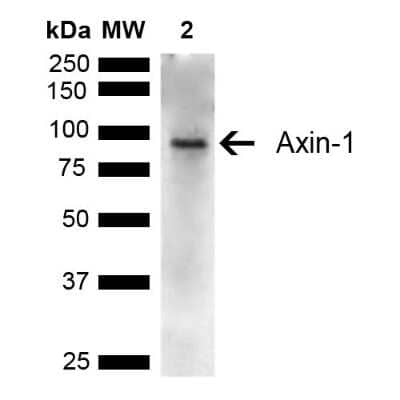 Western Blot: Axin-1 Antibody [NBP3-18243]