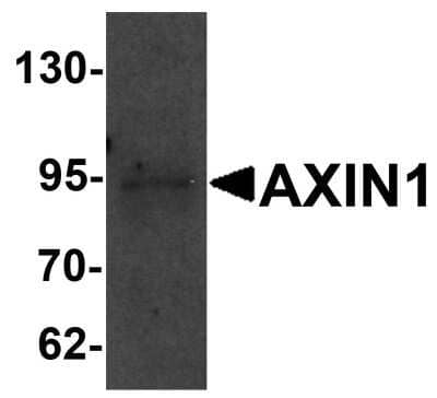 Western Blot: Axin-1 AntibodyBSA Free [NBP1-76483]