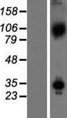 Western Blot: Axin-1 Overexpression Lysate [NBP2-04933]