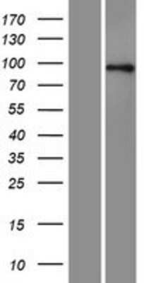 Western Blot: Axin-1 Overexpression Lysate [NBP2-10887]