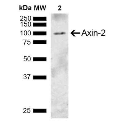 Western Blot: Axin-2 Antibody [NBP3-18241]