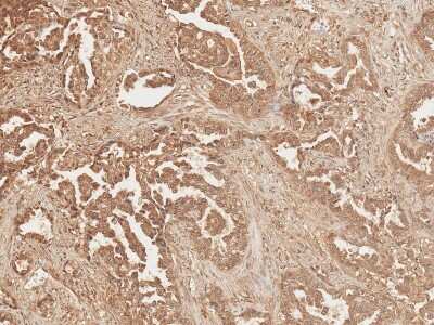 Immunohistochemistry: Axin-2 Antibody [NBP3-18241]