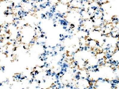 Immunohistochemistry-Paraffin: Axin-2 Antibody [NBP3-12289]