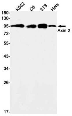 Western Blot: Axin-2 Antibody (S06-3A8) [NBP3-14909]