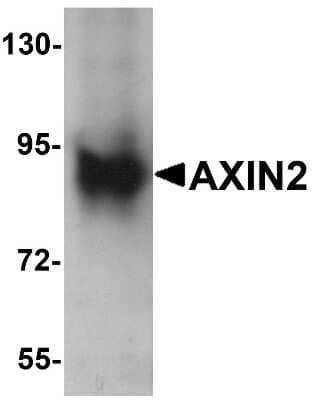 Western Blot: Axin-2 AntibodyBSA Free [NBP1-76526]