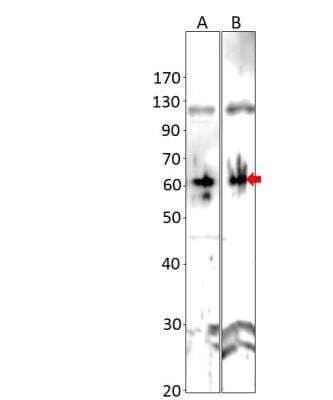 Western Blot: Axin-2 Antibody [NBP3-12289]