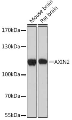 Western Blot: Axin-2 AntibodyAzide and BSA Free [NBP3-15514]