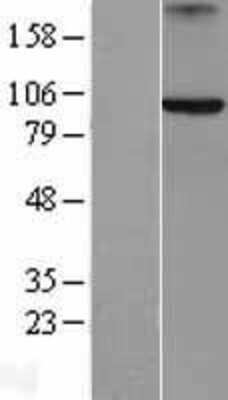 Western Blot: Axin-2 Overexpression Lysate [NBL1-07868]