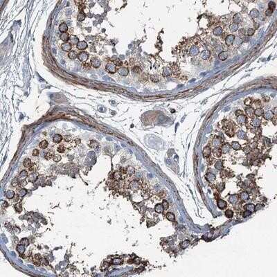 Immunohistochemistry-Paraffin: Axl Antibody [NBP1-83073]