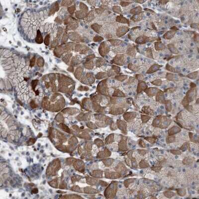 Immunohistochemistry-Paraffin: Axl Antibody [NBP2-38345]