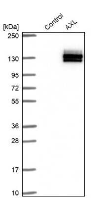 Western Blot: Axl Antibody [NBP1-83073]