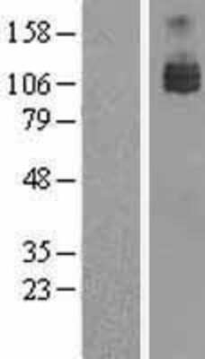 Western Blot: Axl Overexpression Lysate [NBL1-07869]