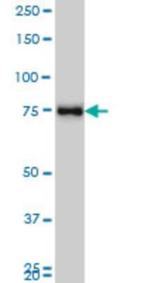 Western Blot: Axotrophin Antibody (2B9) [H00064844-M01]