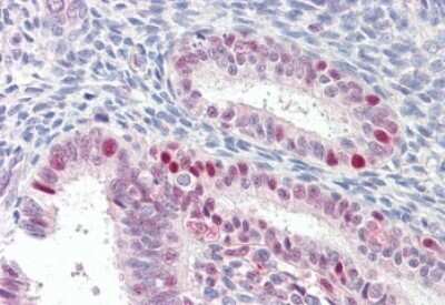 Immunohistochemistry-Paraffin: Axotrophin Antibody [NB100-93417]