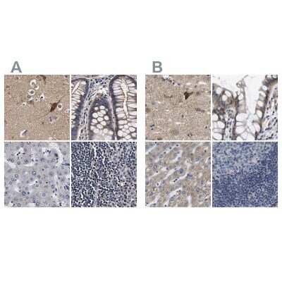 Immunohistochemistry-Paraffin: Axotrophin Antibody [NBP1-90056]